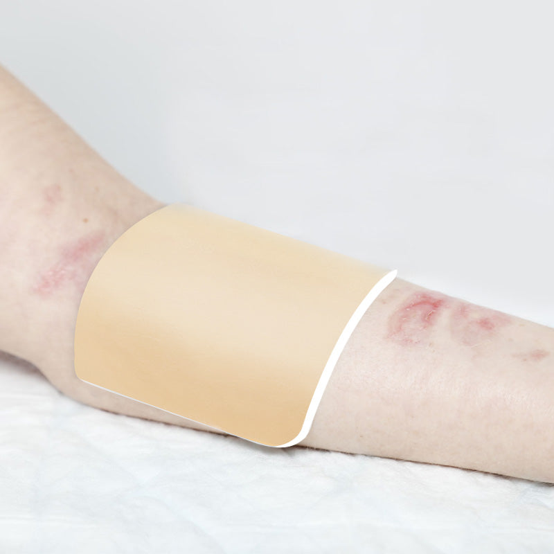 Conkote® ConkoFoam-Foam Dressing Non-Adhesive 10cm X 10cm