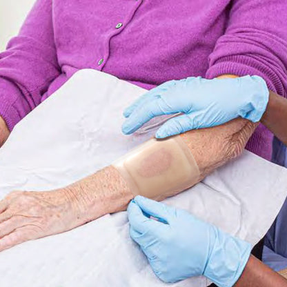 Conkote® ConkoHydro Hydrocolloid Dressing With Border 10cm X 10cm