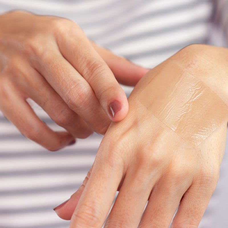 Conkote® ConkoScar-Silicone Scar Sheet 5cm X 15cm