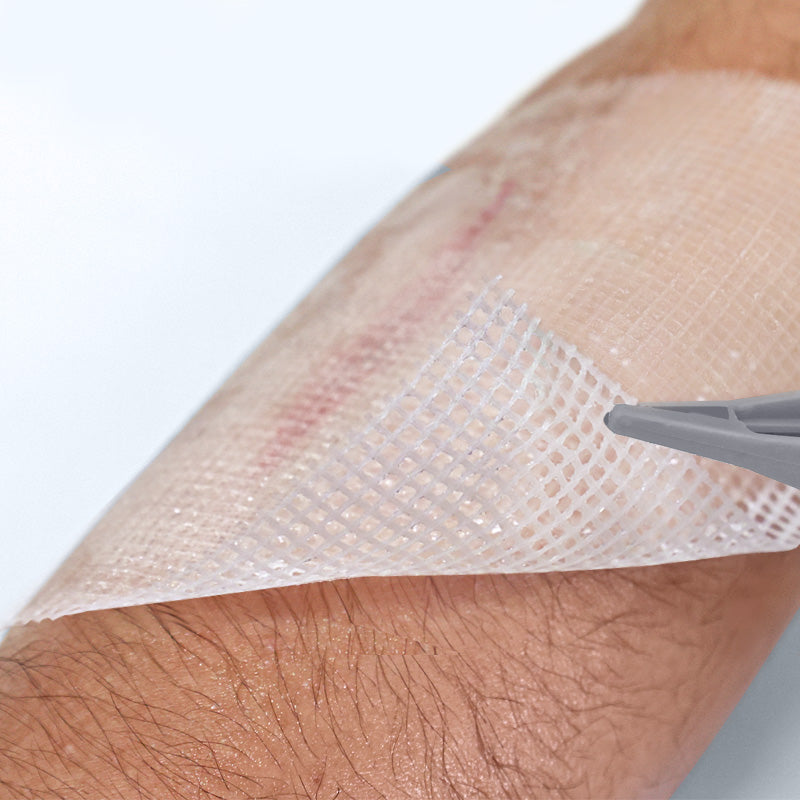 Conkote® ConkoTulle-Vaseline Gauze 10cm X 10cm