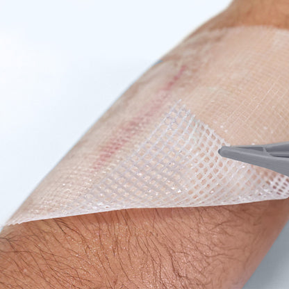 Conkote® ConkoTulle-Vaseline Gauze 10cm X 10cm