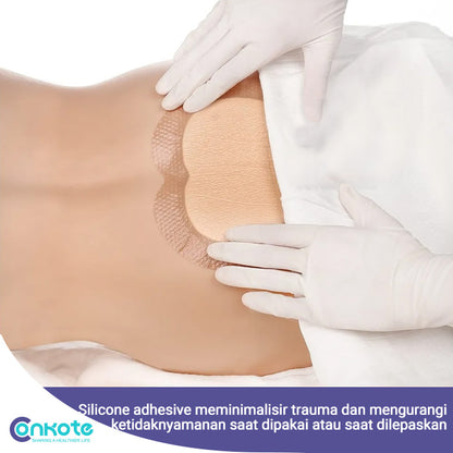 Conkote® ConkoSil-Foam Dressing Silicone Adhesive Border (Sacrum) 18cm X 18cm