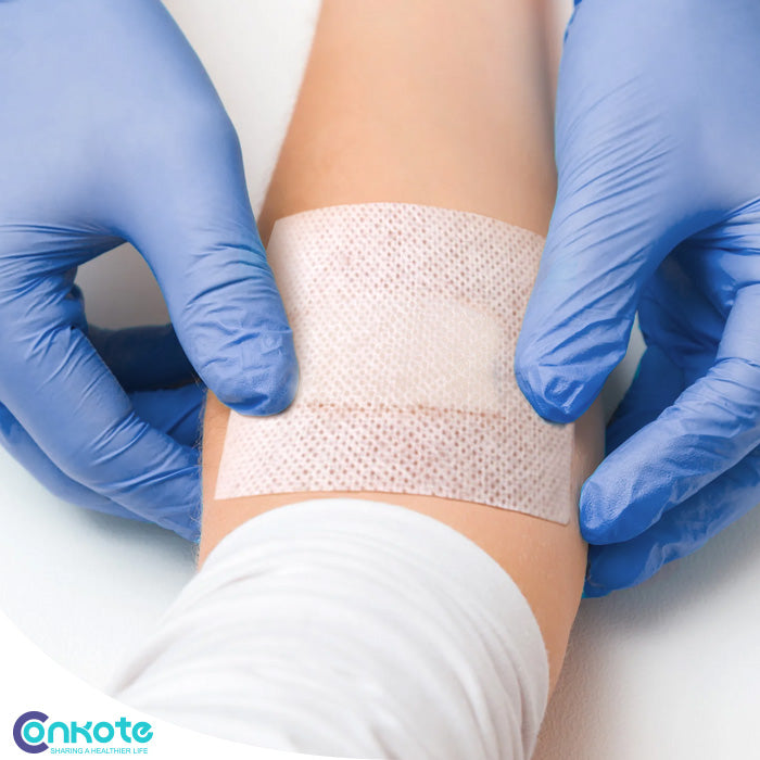 Conkote® Non-woven Adhesive Wound Dressing Strip 15cm X 5m