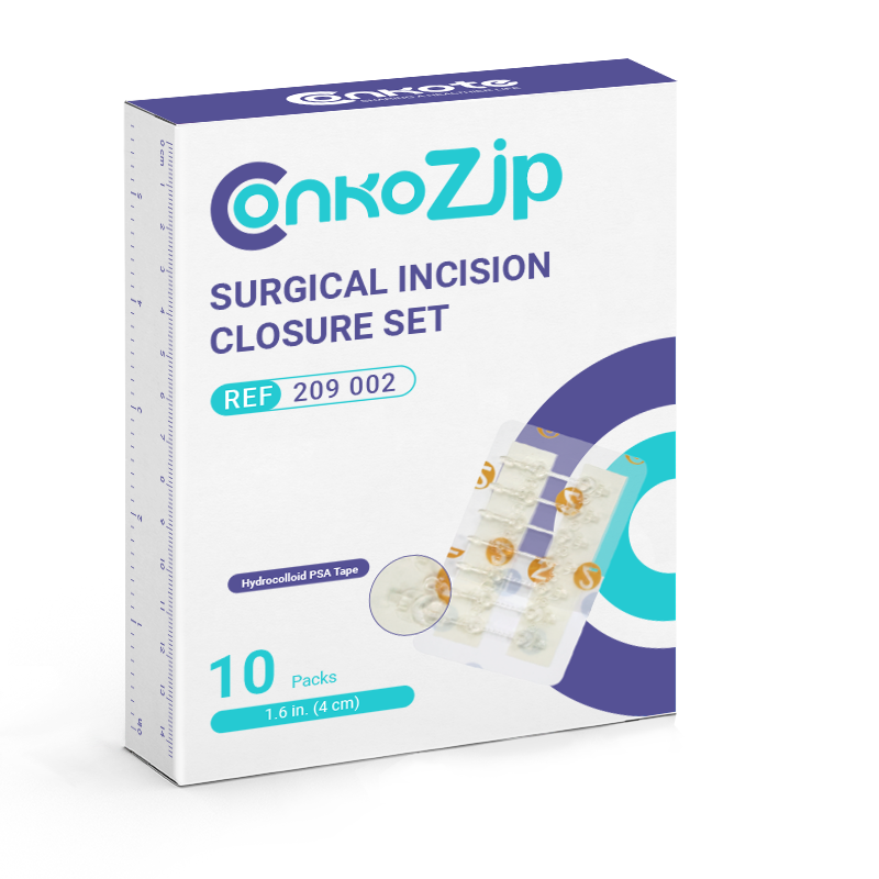 Conkote® ConkoZip-Surgical Incision Closure Set 8cm