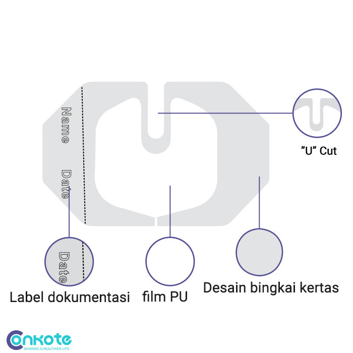 Conkote® ConkoI.V Transparent-Frame Style Transparent Film I.V.Dressing 4.4cm X 4.4cm