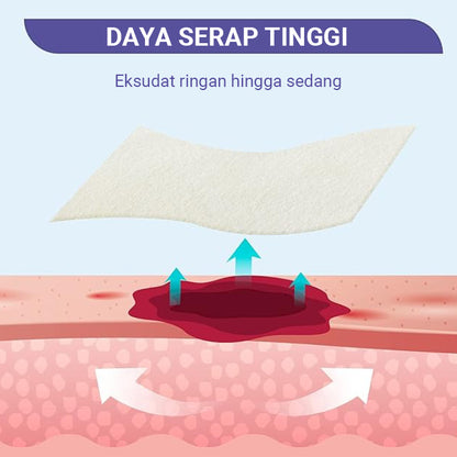 Conkote® ConkoAg-Silver Alginate Dressing 5cm X 5cm