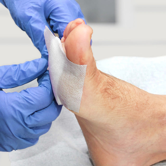 Conkote® Non-woven Adhesive Wound Dressing Strip 15cm X 5m