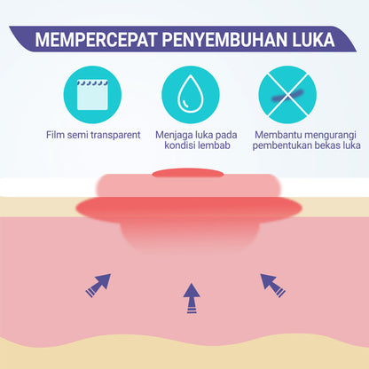 Conkote® ConkoHydro-Hydrocolloid Dressing super thin 10cm X 10cm