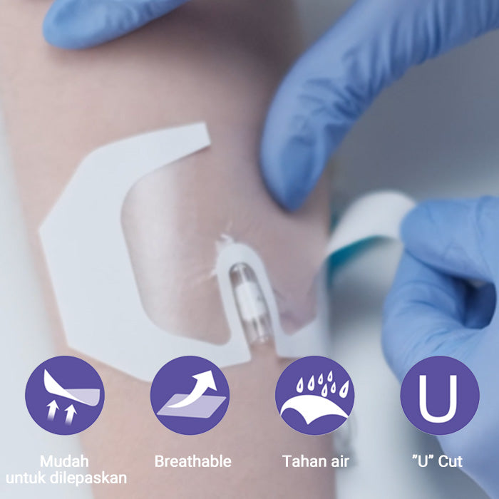 Conkote® ConkoI.V Transparent-Frame Style Transparent Film I.V.Dressing 4.4cm X 4.4cm