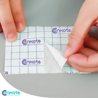Conkote® Non-woven Adhesive Wound Dressing Strip 5cm X 10m