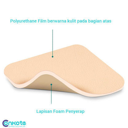Conkote® ConkoFoam-Foam Dressing Non-adhesive 15cm X 20cm