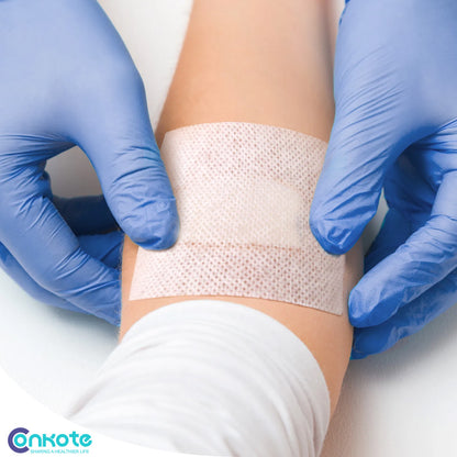Conkote® ConkoFix-Non-woven Adhesive Wound Dressing Strip 10cm X 5m