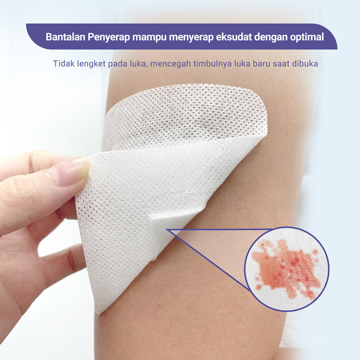Conkote® ConkoShiled - Non-woven Adhesive Wound Dressing with Pad 10cm X 25cm