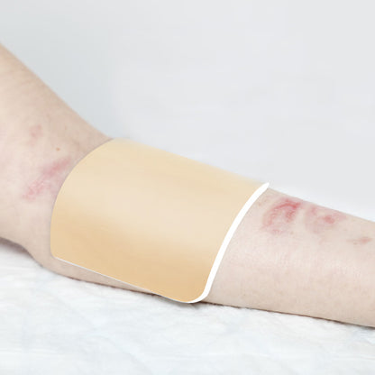 Conkote® ConkoFoam-Foam Dressing Non-Adhesive 10cm X 10cm